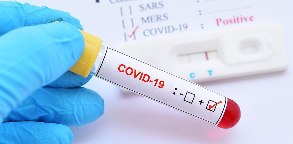 २४ घण्टामा थप ४१ जनामा कोरोना भाइरस सङ्क्रमण